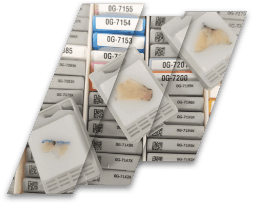 FFPE-tissue-biorepository-FFPE-Tissues FFPE tissue slides