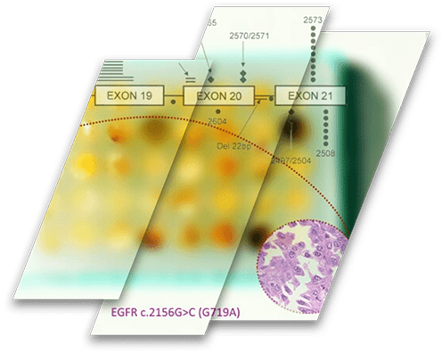Molecularly Characterized Tissue Microarrays