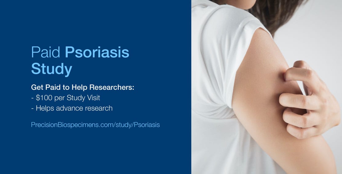 Mar15-2021-Psoriasis-Ad-FB Mar15-2021-Psoriasis-Ad-FB